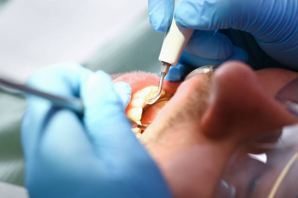 Best Urgent Care for Lost Fillings or Crowns in Redwood, TX